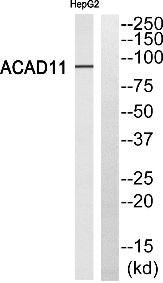 ACAD-11 Rabbit Polyclonal Antibody