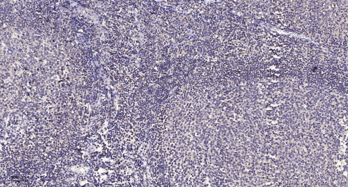 ACAD-9 Rabbit Polyclonal Antibody