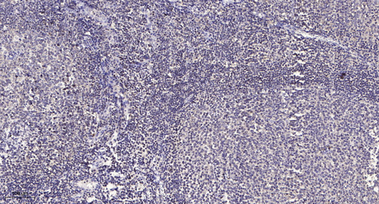 ACAD-9 Rabbit Polyclonal Antibody