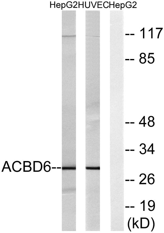 ACBD6 Rabbit Polyclonal Antibody