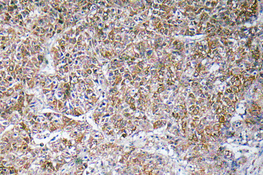 ACBP Rabbit Polyclonal Antibody