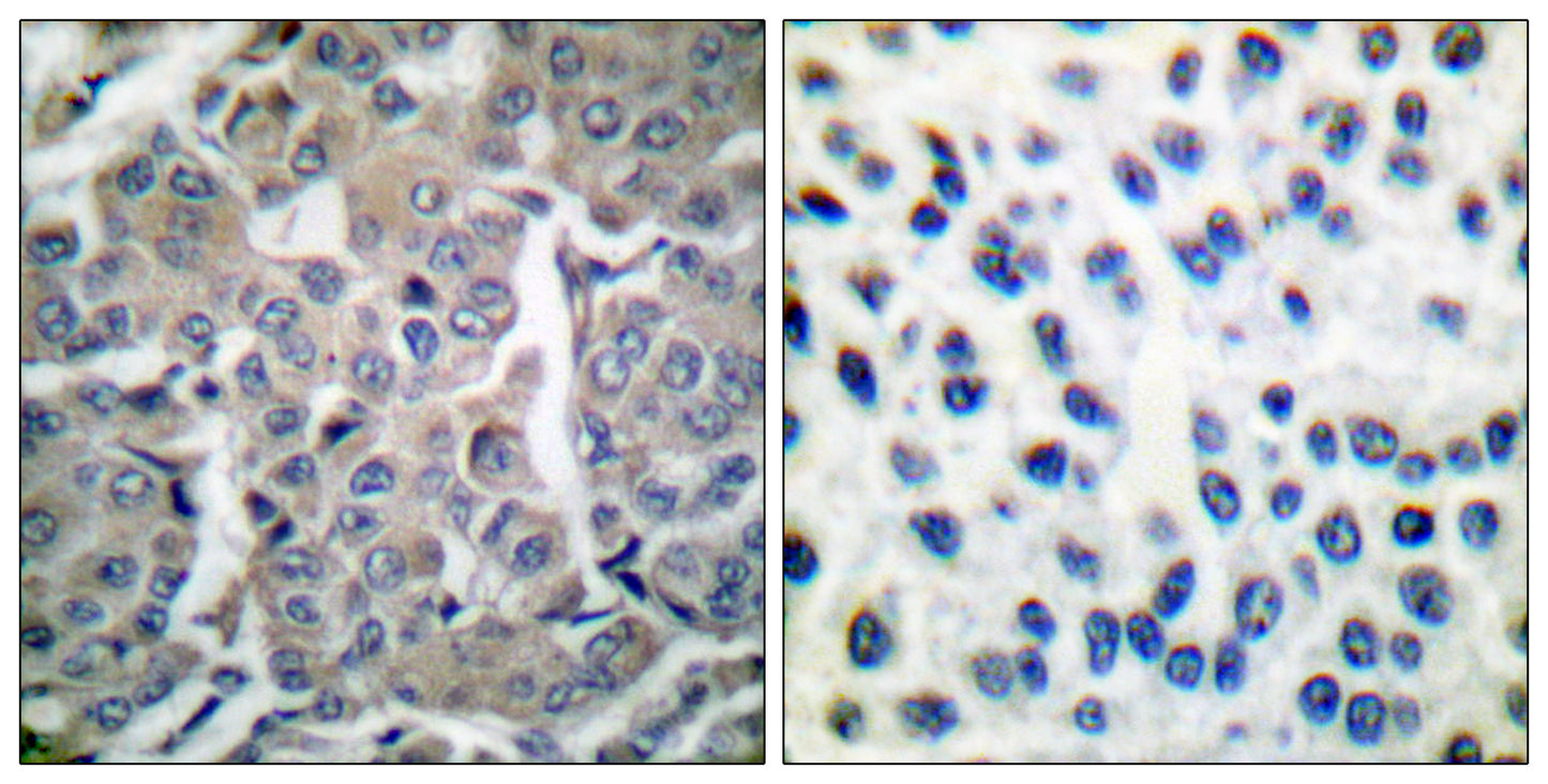 ACCα Rabbit Polyclonal Antibody