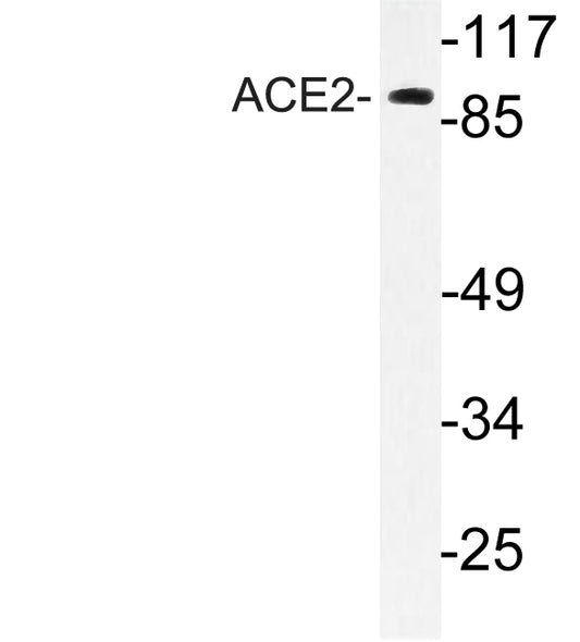 ACE2 Rabbit Polyclonal Antibody