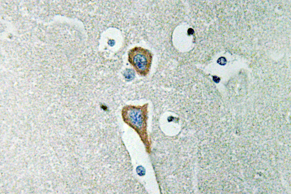 AChE Rabbit Polyclonal Antibody