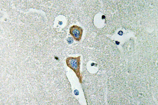 AChE Rabbit Polyclonal Antibody