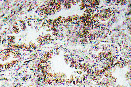 AChRα1 Rabbit Polyclonal Antibody