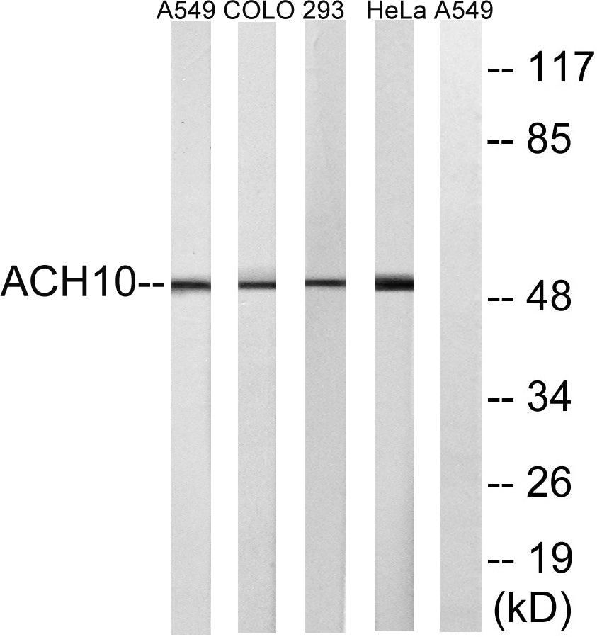 AChRα10 Rabbit Polyclonal Antibody