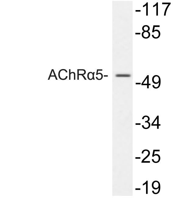 AChRα5 Rabbit Polyclonal Antibody