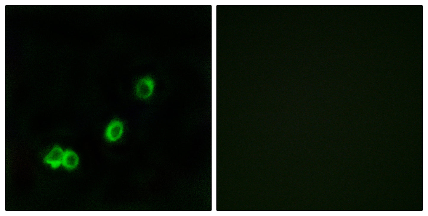 ACOT1 Rabbit Polyclonal Antibody