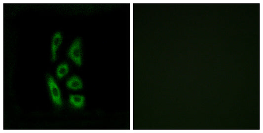 ACOT12 Rabbit Polyclonal Antibody