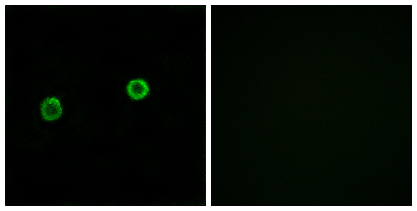 ACOT4 Rabbit Polyclonal Antibody