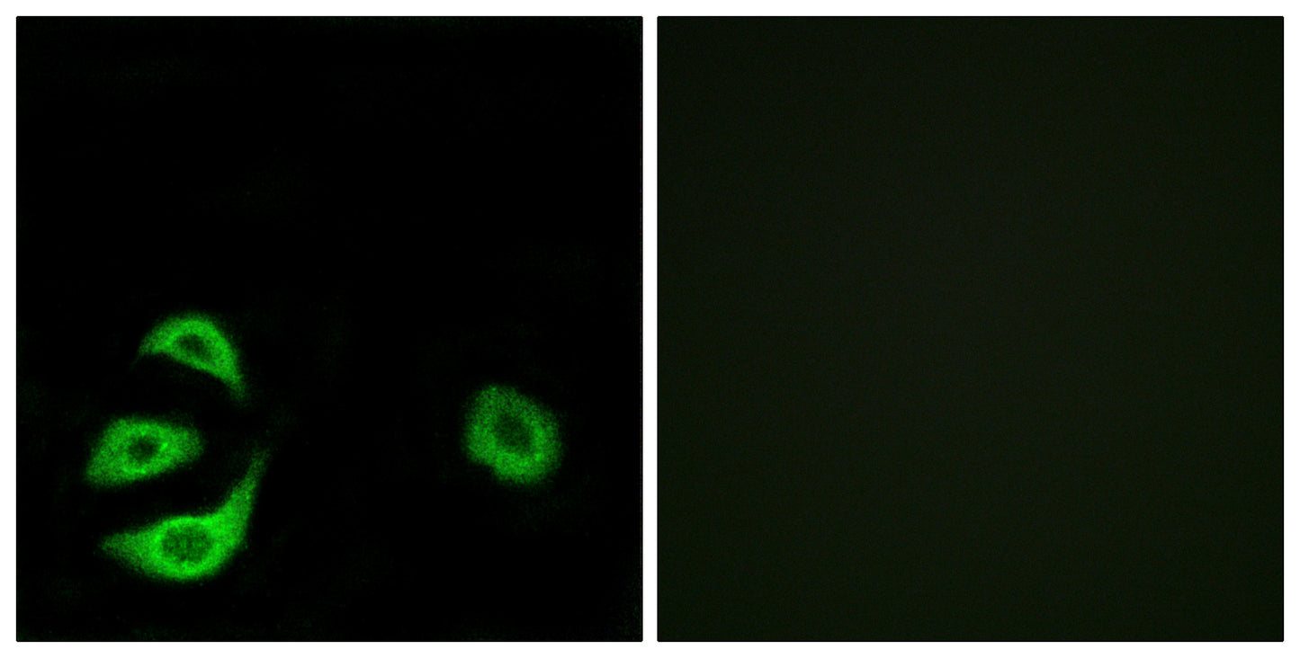 ACOT8 Rabbit Polyclonal Antibody