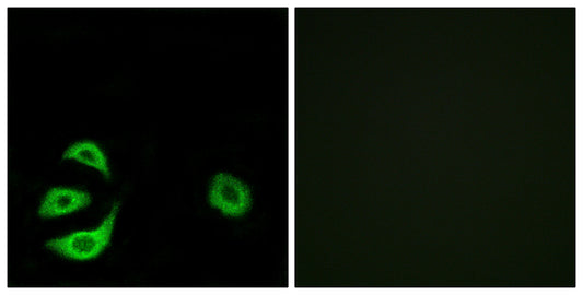 ACOT8 Rabbit Polyclonal Antibody