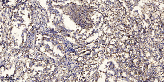 ACOT9 Rabbit Polyclonal Antibody