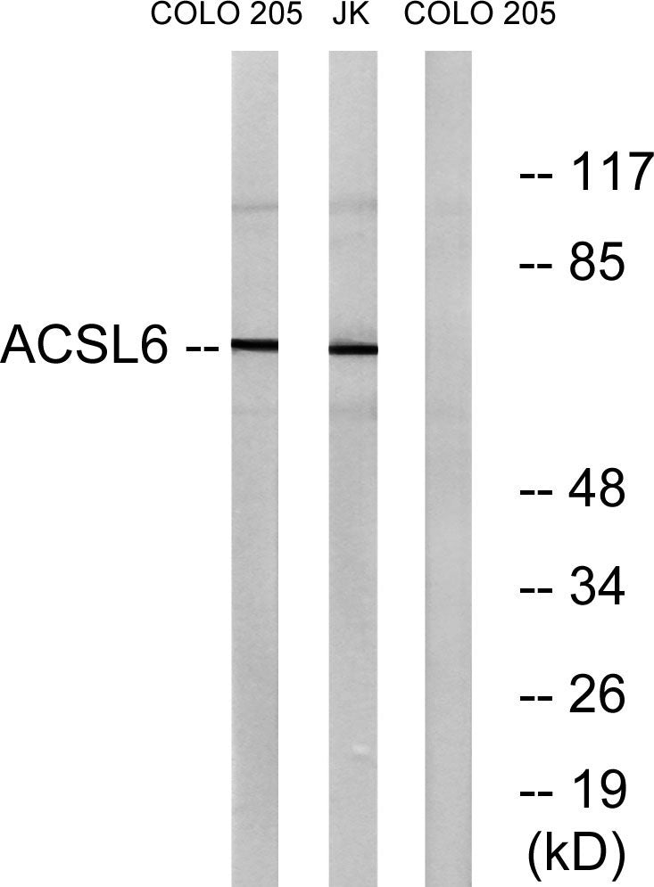 ACSL6 Rabbit Polyclonal Antibody