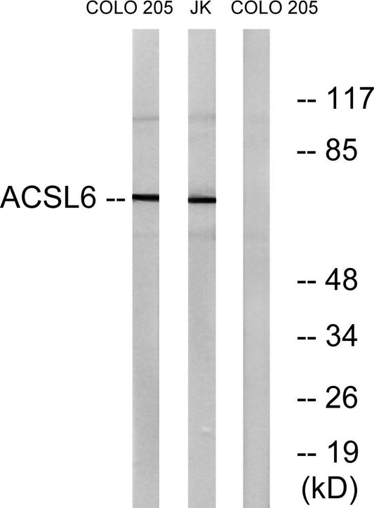 ACSL6 Rabbit Polyclonal Antibody