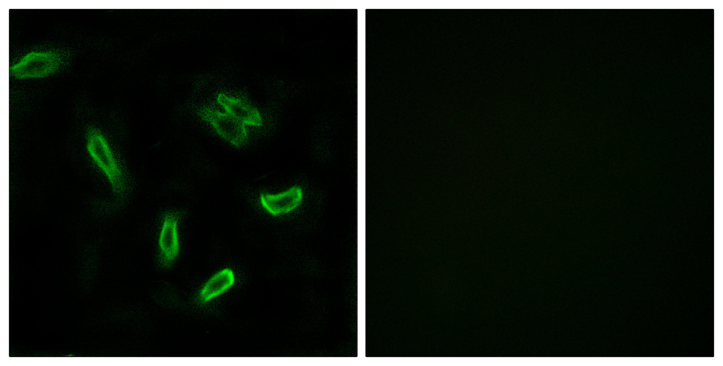 ACSVL6 Rabbit Polyclonal Antibody