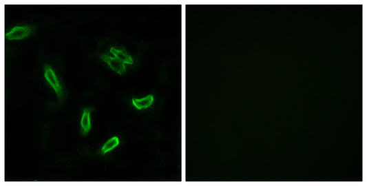 ACSVL6 Rabbit Polyclonal Antibody