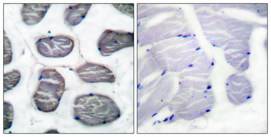 Actin α1 Rabbit Polyclonal Antibody