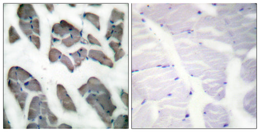 Actin α3 Rabbit Polyclonal Antibody