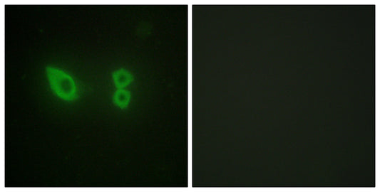 Actinin-α2/3 Rabbit Polyclonal Antibody