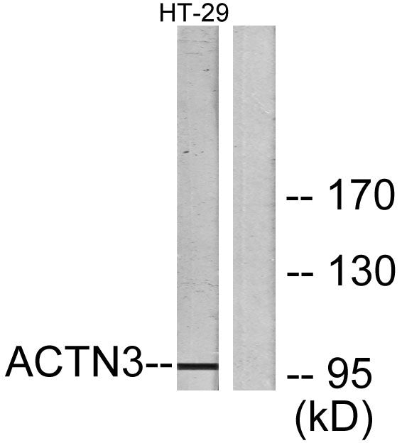 Actinin-α3 Rabbit Polyclonal Antibody