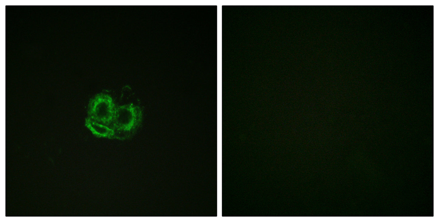 Actin-α/γ Rabbit Polyclonal Antibody