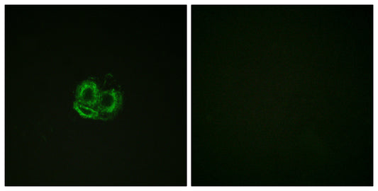 Actin-α/γ Rabbit Polyclonal Antibody