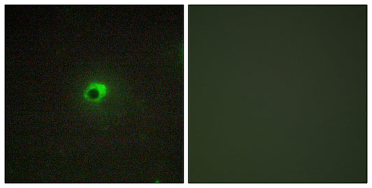 ACTR-IC Rabbit Polyclonal Antibody