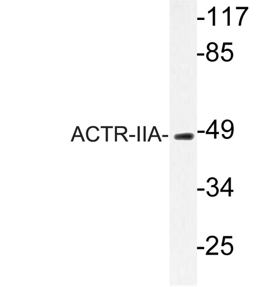 ACTR-IIA Rabbit Polyclonal Antibody