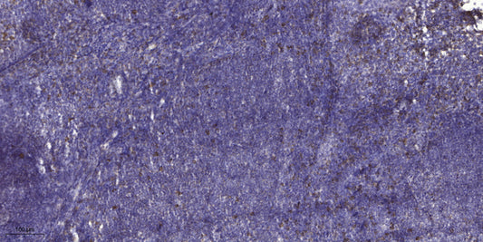 ADAMTS-17 Rabbit Polyclonal Antibody