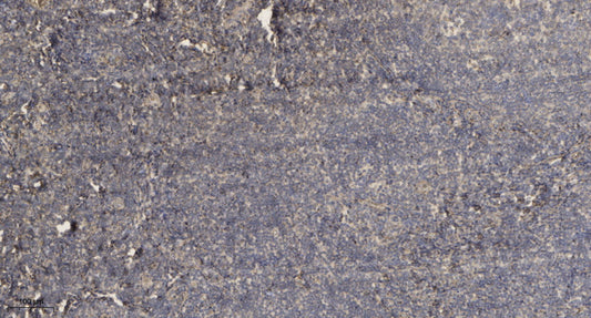 ADAMTS-7 Rabbit Polyclonal Antibody
