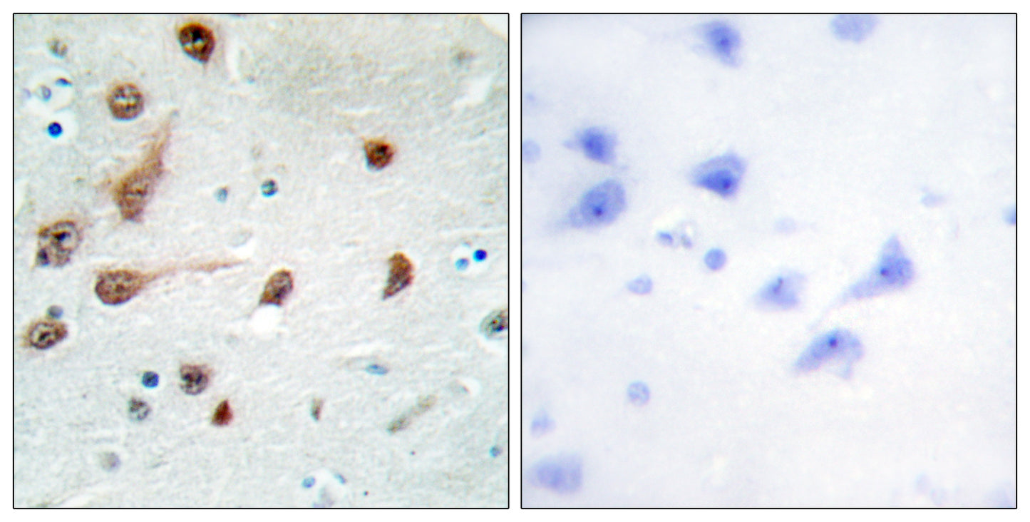 ADAR1 Rabbit Polyclonal Antibody