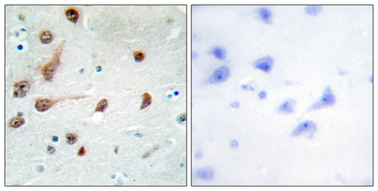 ADAR1 Rabbit Polyclonal Antibody