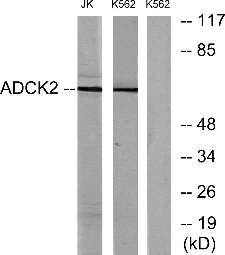ADCK2 Rabbit Polyclonal Antibody