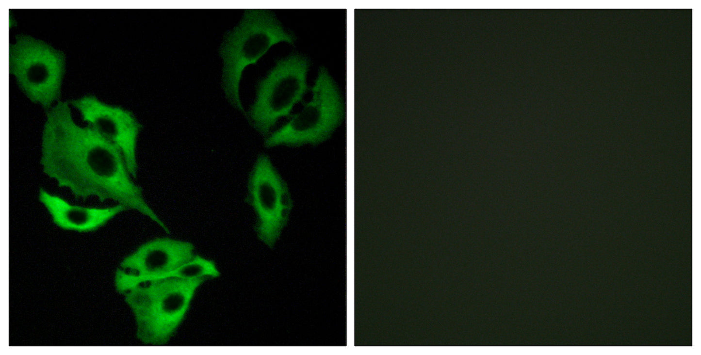 ADCK4 Rabbit Polyclonal Antibody