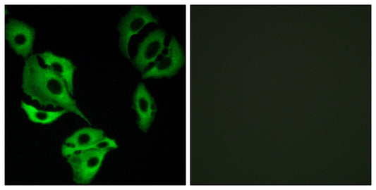 ADCK4 Rabbit Polyclonal Antibody