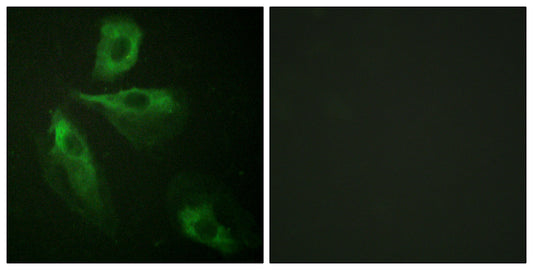 ADD1 Rabbit Polyclonal Antibody