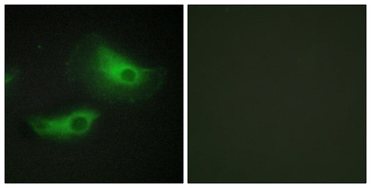 Adducin β Rabbit Polyclonal Antibody