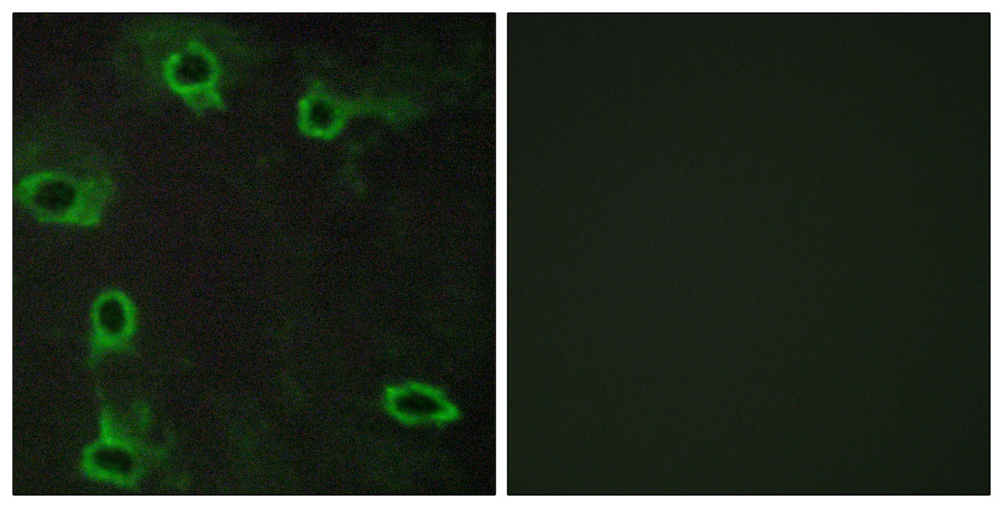 Adenosine A2A-R Rabbit Polyclonal Antibody