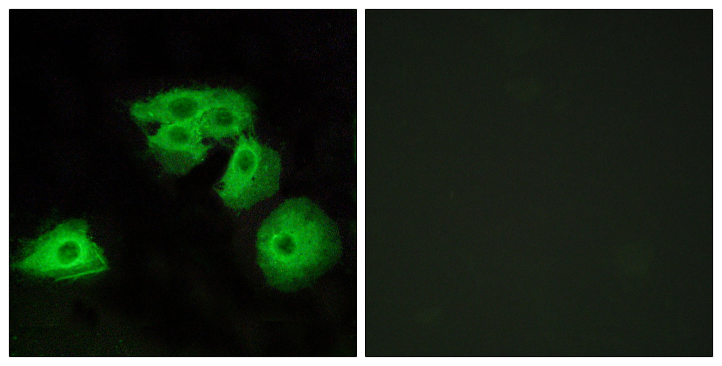 Adenosine A3-R Rabbit Polyclonal Antibody
