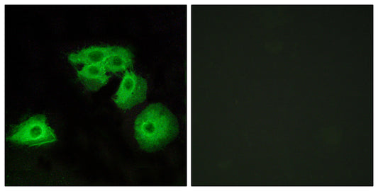 Adenosine A3-R Rabbit Polyclonal Antibody