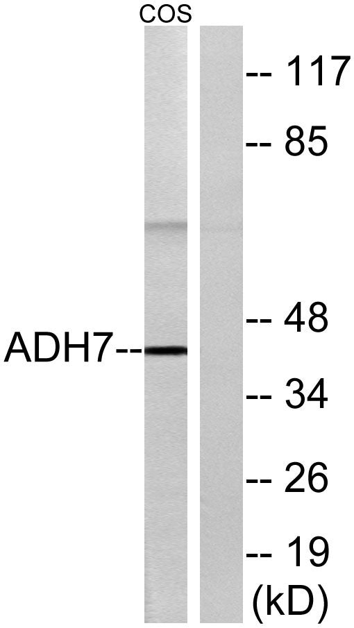 ADH7 Rabbit Polyclonal Antibody