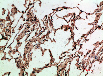 ADI1 Rabbit Polyclonal Antibody