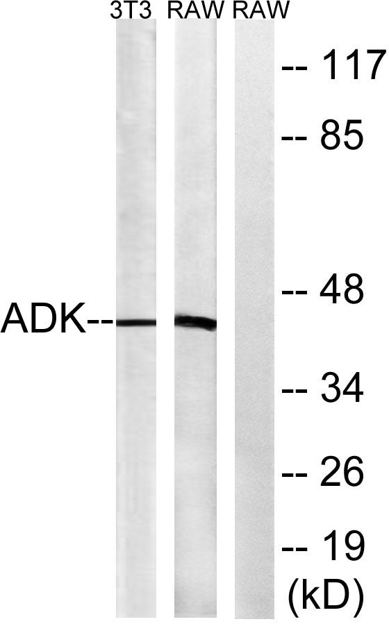 ADK Rabbit Polyclonal Antibody
