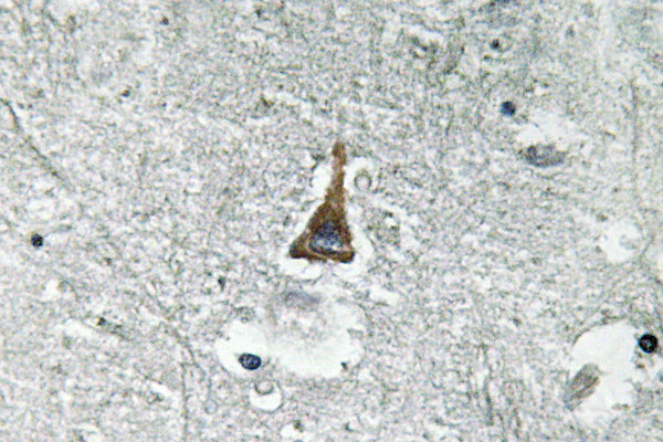 ADM Rabbit Polyclonal Antibody