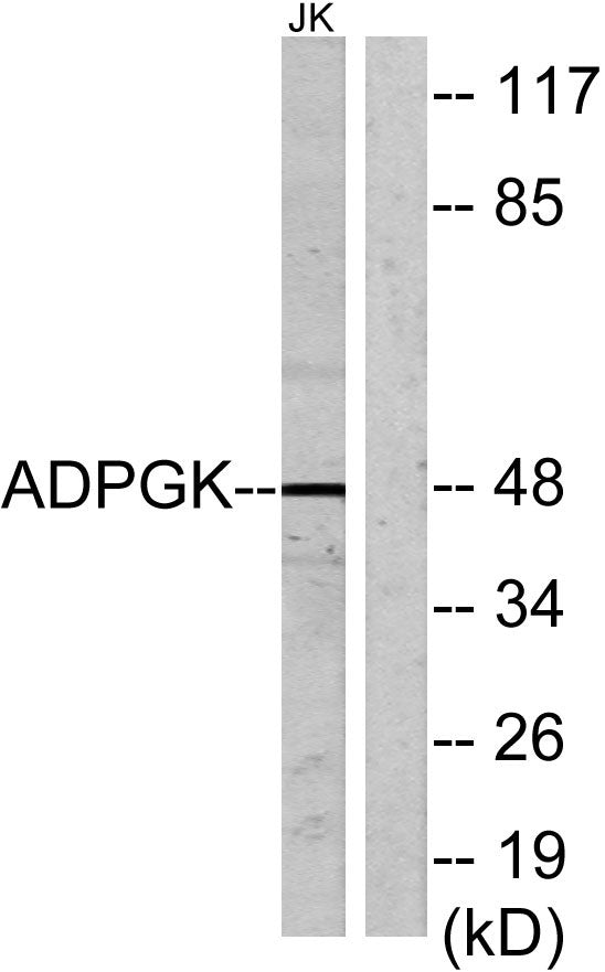 ADP-GK Rabbit Polyclonal Antibody