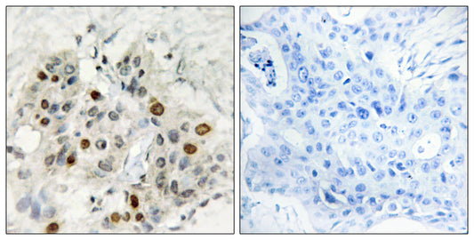 AF-4 Rabbit Polyclonal Antibody