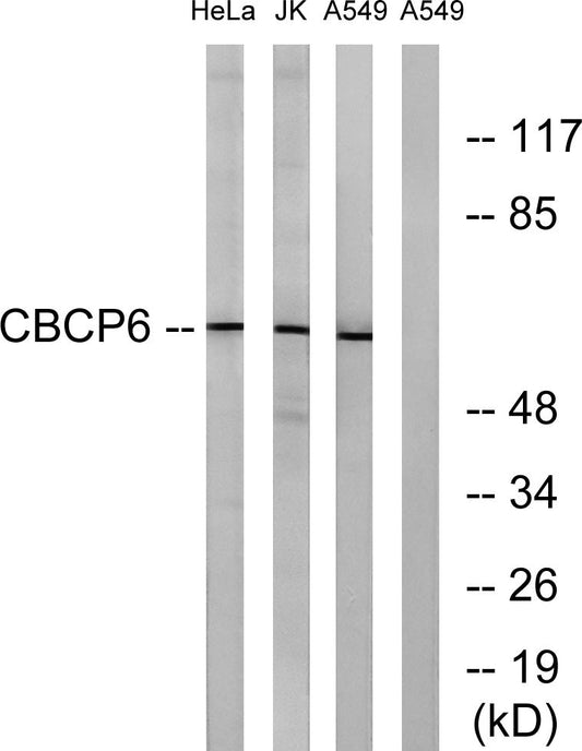 AGBL4 Rabbit Polyclonal Antibody