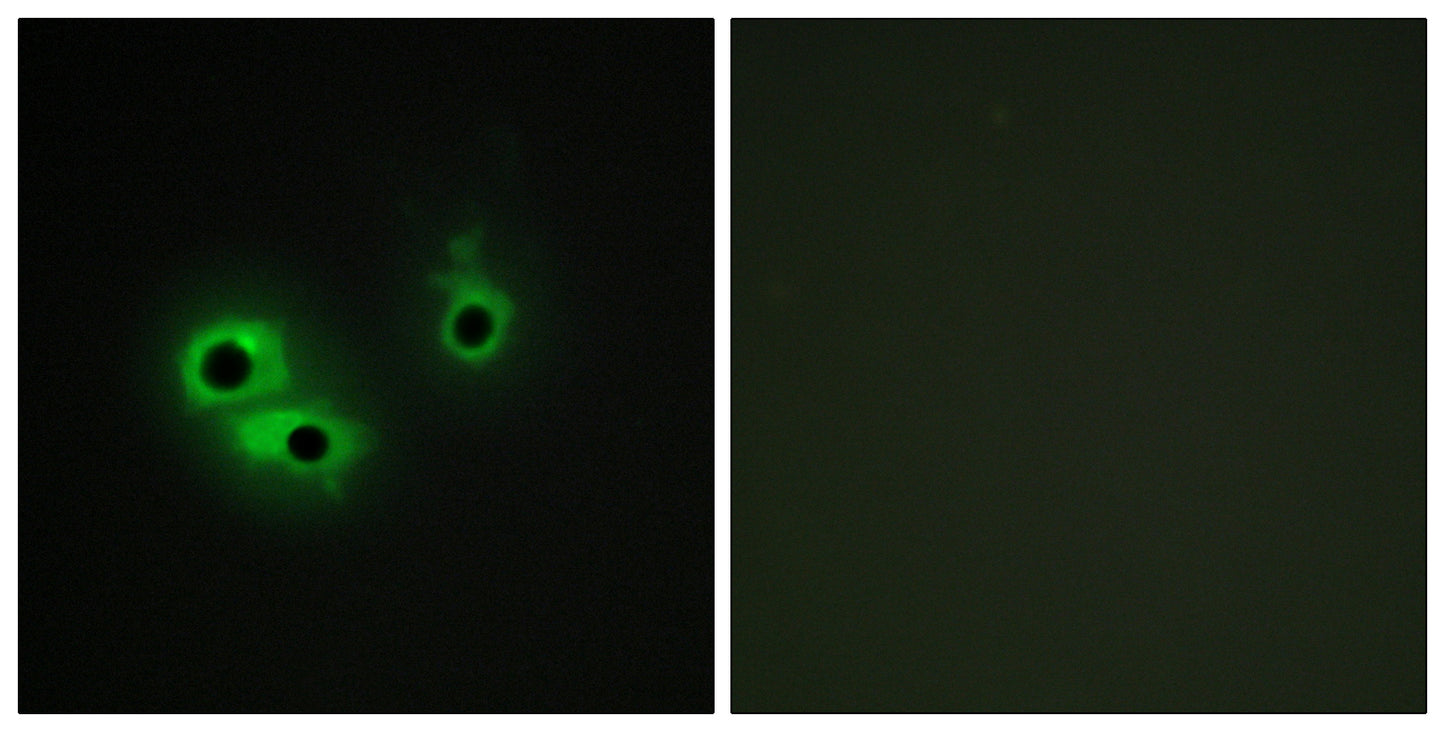 AGR3 Rabbit Polyclonal Antibody